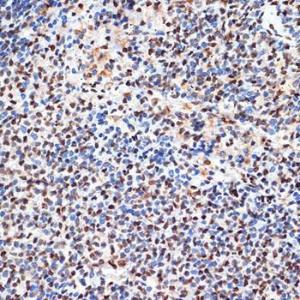 Immunohistochemistry analysis of paraffin-embedded rat spleen using Anti-PHAPI2/APRIL Antibody [ARC2014] (A307147) at a dilution of 1:100 (40x lens) Perform microwave antigen retrieval with 10 mM Tris/EDTA buffer pH 90 before commencing with IHC staining protocol