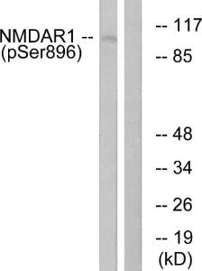 Western blot analysis of lysates from K562 cells treated with PMA 125ng/ml 30' using Anti-NMDAR1 (phospho Ser896) Antibody. The right hand lane represents a negative control, where the antibody is blocked by the immunising peptide