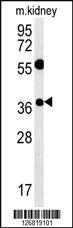 Anti-TSPAN3 Rabbit Polyclonal Antibody