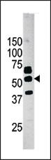 Anti-PANK2 Rabbit Polyclonal Antibody