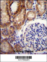 Anti-TMEM66 Rabbit Polyclonal Antibody