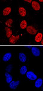 Anti-LEDGF Mouse Monoclonal Antibody [clone: 762815]