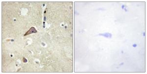 Immunohistochemical analysis of paraffin-embedded human brain using Anti-NMDAR1 (phospho Ser896) Antibody. The right hand panel represents a negative control, where the antibody was pre-incubated with the immunising peptide