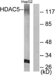 Western blot analysis of lysates from HepG2 cells using Anti-HDAC5 Antibody The right hand lane represents a negative control, where the antibody is blocked by the immunising peptide