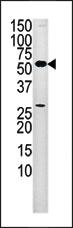 Anti-PANK2 Rabbit Polyclonal Antibody