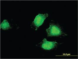 Anti-EDC4 Mouse Monoclonal Antibody [clone: 2E2]