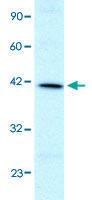 Anti-FOXF2 Rabbit Polyclonal Antibody