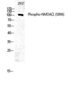 Western blot analysis of 293T using Anti-NMDAR1 (phospho Ser896) Antibody