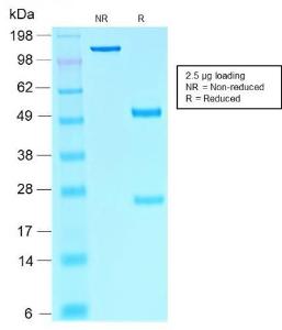 SDS-PAGE analysis of Anti-SOX10 Antibody [rSOX10/1074] under non-reduced and reduced conditions; showing intact IgG and intact heavy and light chains, respectively. SDS-PAGE analysis confirms the integrity and purity of the antibody