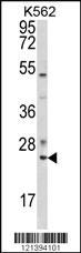 Anti-RAB7A Rabbit Polyclonal Antibody