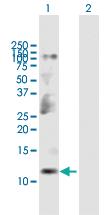 Anti-CKS2 Mouse Polyclonal Antibody