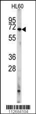 Anti-PDE8A Rabbit Polyclonal Antibody (Biotin)