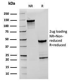 Anti-CD27 Mouse Recombinant Antibody [Clone: rLPFS2/1611]