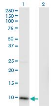 Anti-CKS2 Mouse Monoclonal Antibody [clone: 2H5-2C4]