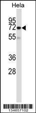 Anti-PAK3 Rabbit Polyclonal Antibody