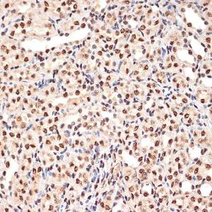 Immunohistochemistry analysis of paraffin-embedded mouse kidney using Anti-PHAPI2/APRIL Antibody [ARC2014] (A307147) at a dilution of 1:100 (40x lens) Perform microwave antigen retrieval with 10 mM Tris/EDTA buffer pH 90 before commencing with IHC staining protocol