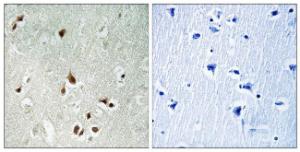 Immunohistochemical analysis of paraffin-embedded human brain tissue using Anti-HDAC5 Antibody The right hand panel represents a negative control, where the antibody was pre-incubated with the immunising peptide