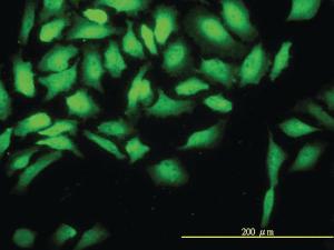 Anti-CKS2 Mouse Monoclonal Antibody [clone: 2H5-2C4]