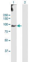 Anti-EPS8L2 Rabbit Polyclonal Antibody