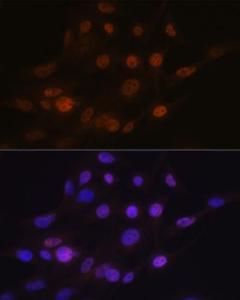 Immunofluorescence analysis of C6 cells using Anti-PHAPI2/APRIL Antibody [ARC2014] (A307147) at a dilution of 1:100 (40x lens) DAPI was used to stain the cell nuclei (blue)