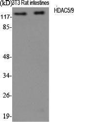 Western blot analysis of various cells using Anti-HDAC5 Antibody