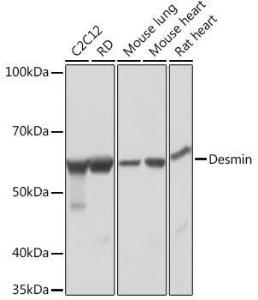 Western blot analysis of extracts of various cell lines, using Anti-Desmin Antibody [ARC0235] (A305689) at 1:1,000 dilution