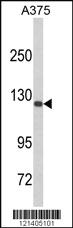 Anti-DSC1 Rabbit Polyclonal Antibody