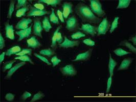 Anti-CKS2 Mouse Monoclonal Antibody [clone: 2H5-2C4]