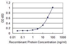 Anti-EDC4 Mouse Monoclonal Antibody [clone: 2E2]