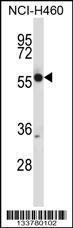 Anti-CRMP1 Rabbit Polyclonal Antibody (Biotin)