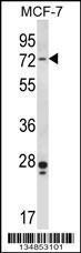 Anti-PAK4 Rabbit Polyclonal Antibody (AP (Alkaline Phosphatase))