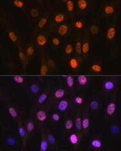 Immunofluorescence analysis of NIH-3T3 cells using Anti-PHAPI2/APRIL Antibody [ARC2014] (A307147) at a dilution of 1:100 (40x lens) DAPI was used to stain the cell nuclei (blue)