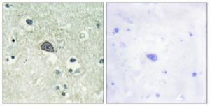 Immunohistochemical analysis of paraffin-embedded human brain using Anti-NMDAR1 (phospho Ser890) Antibody. The right hand panel represents a negative control, where the antibody was pre-incubated with the immunising peptide.