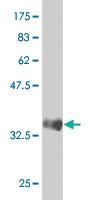 Anti-SREBF1 Mouse Monoclonal Antibody [clone: 4G4]