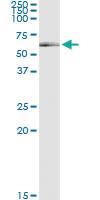 Anti-ATG16L1 Polyclonal Antibody Pair