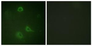 Immunofluorescence analysis of A549 cells using Anti-NMDAR1 (phospho Ser890) Antibody. The right hand panel represents a negative control, where the antibody was pre-incubated with the immunising peptide.