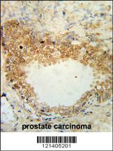 Anti-DSC1 Rabbit Polyclonal Antibody