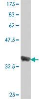 Anti-SPRY1 Mouse Polyclonal Antibody