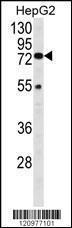 Anti-Hexosaminidase A. Rabbit Polyclonal Antibody (Biotin)