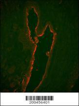 Anti-LTF Mouse Monoclonal Antibody [clone: 119CT80.1.1]