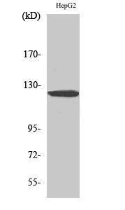 Western blot analysis of HepG2 cells using Anti-HDAC5 Antibody