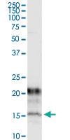 Anti-KCNE1 Mouse Monoclonal Antibody [clone: 2A6]