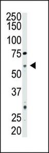 Anti-NT5E Rabbit Polyclonal Antibody (AP (Alkaline Phosphatase))