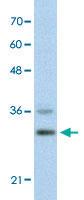 Anti-FOXQ1 Rabbit Polyclonal Antibody