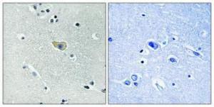 Immunohistochemical analysis of paraffin-embedded human brain using Anti-NMDAR1 (phospho Ser890) Antibody 1:100 (4°C overnight). The right hand panel represents a negative control, where the antibody was pre-incubated with the immunising peptide.