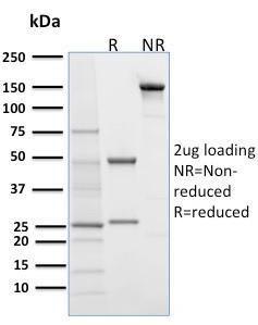 Antibody anti-desmoglein 1 32-2B 100 µg