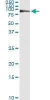 Anti-KIF2C Mouse Monoclonal Antibody [clone: 1G2]