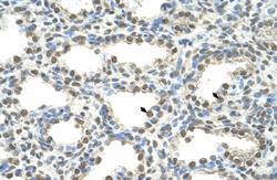 Anti-FOXQ1 Rabbit Polyclonal Antibody