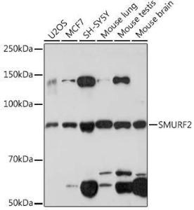 Anti-SMURF 2 Rabbit Monoclonal Antibody [clone: ARC1897]