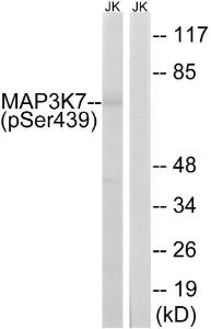 Western blot analysis of lysates from Jurkat cells treated with PMA 125ng/ml 30' using Anti-MAP3K7 (phospho Ser439) Antibody. The right hand lane represents a negative control, where the antibody is blocked by the immunising peptide.